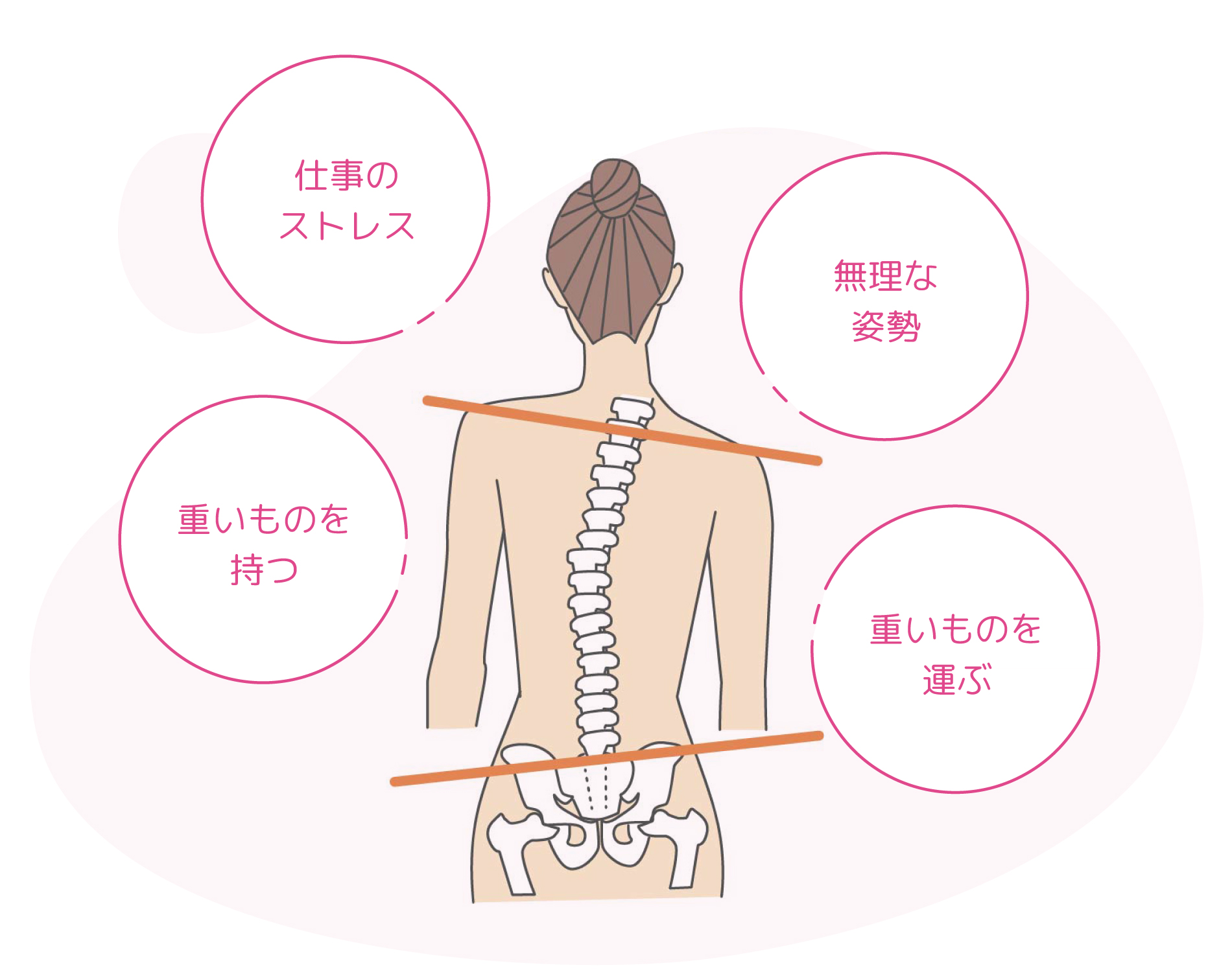 Ｃ＆Ａアトラス療法のイメージ
